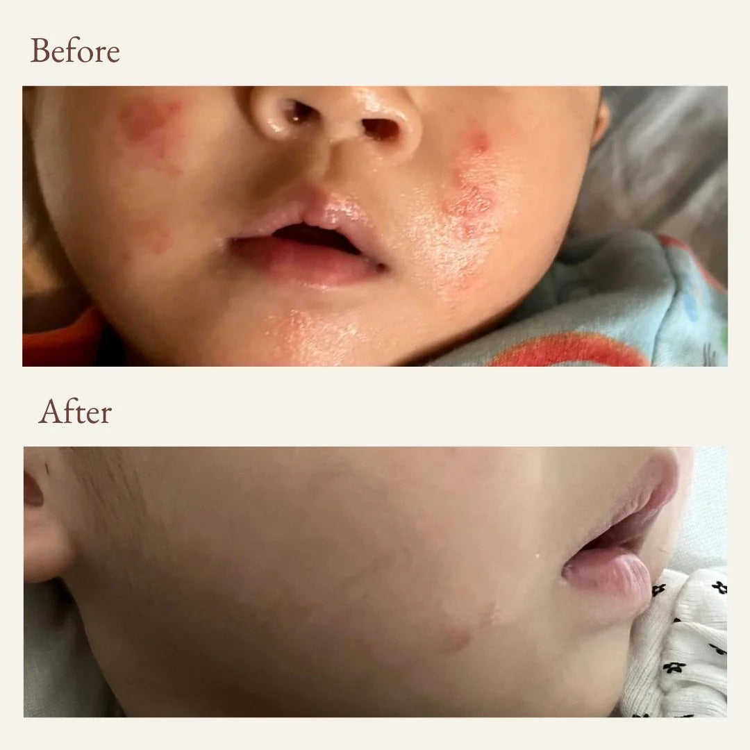 Vivaiodays Olive Oil Rescue Balm Gel