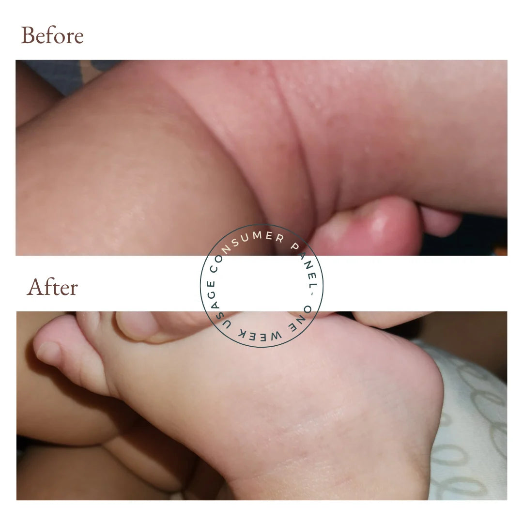 Vivaiodays Olive Oil Rescue Balm Gel