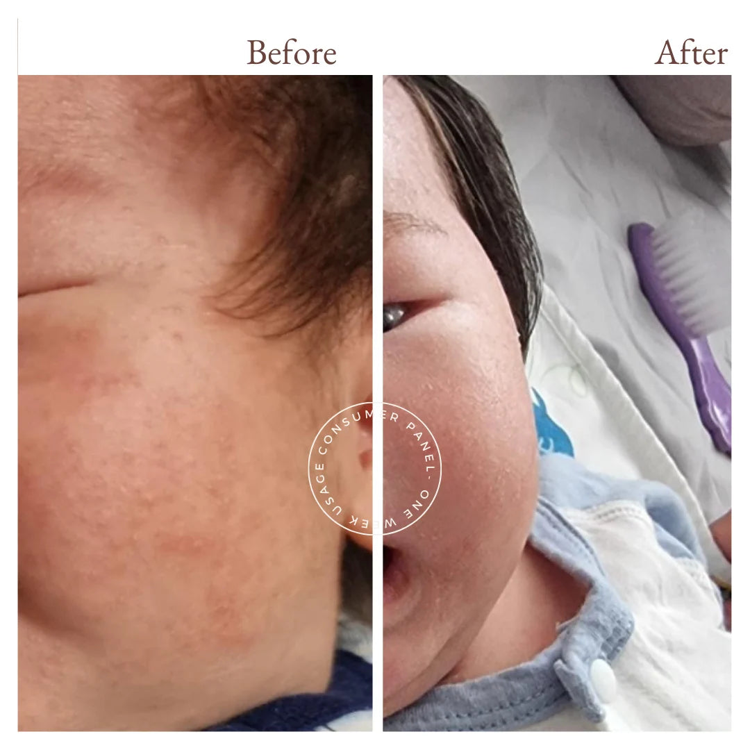 Vivaiodays Olive Oil Rescue Balm Gel